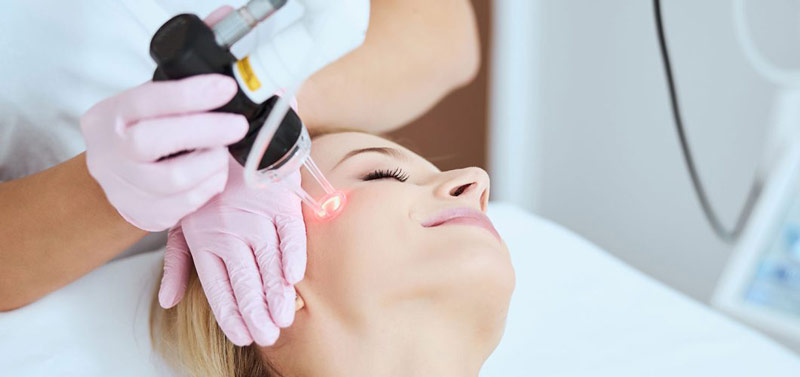 لیزر مو‌های کرکی امکان پذیر است؟